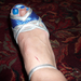 self inflicted wound
